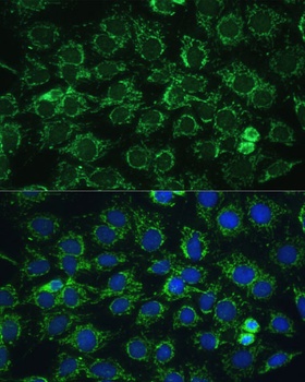 ATP5C1 Antibody