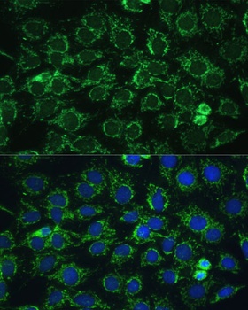 ATP5C1 Antibody