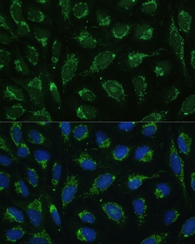 ATP5C1 Antibody