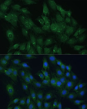 ARL1 Antibody