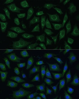 ARL1 Antibody