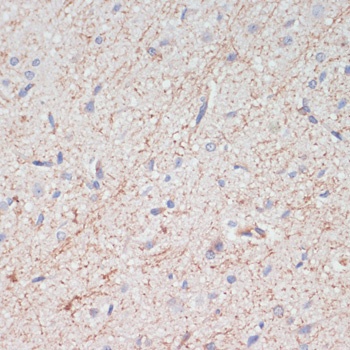 SLC6A3 Antibody