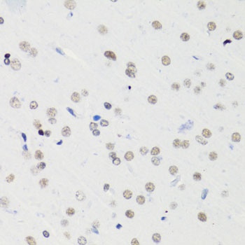 H4K5AC Antibody