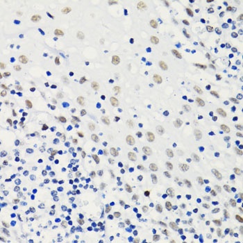 H4K5AC Antibody
