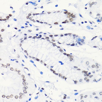 H4K5AC Antibody