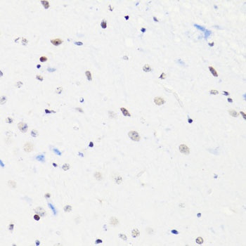 H4K5AC Antibody