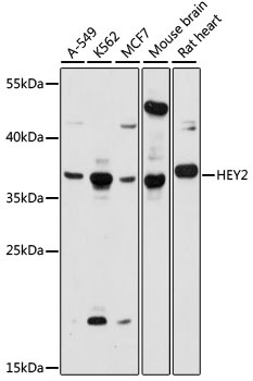 HEY2 Antibody