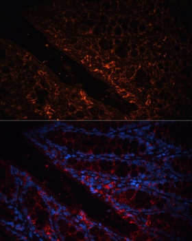 GPA33 Antibody