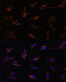 TGFB1 Antibody