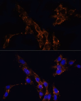 TGFB1 Antibody