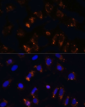 TGFB1 Antibody