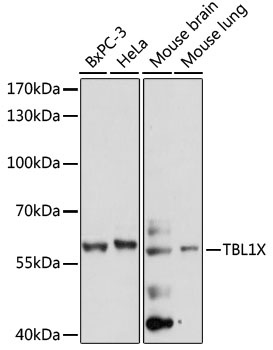 TBL1X Antibody