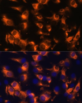 SSTR2 Antibody