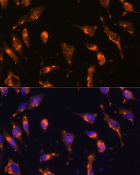 SSTR2 Antibody