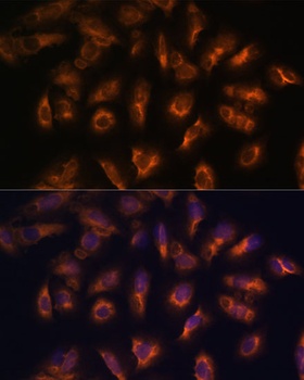 SSTR2 Antibody