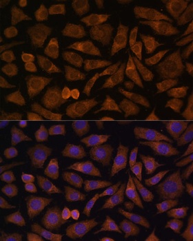RABIF Antibody