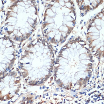 HSPA1A Antibody