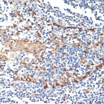 HSPA1A Antibody