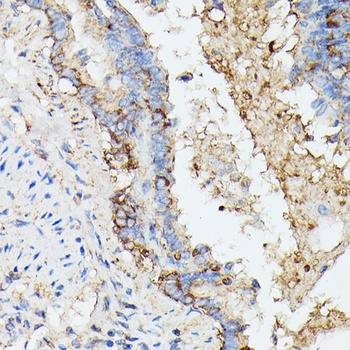 KRT14 Antibody