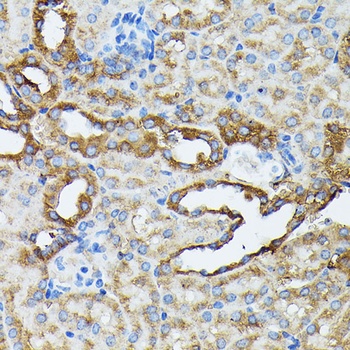 KRT14 Antibody