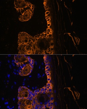 KRT14 Antibody