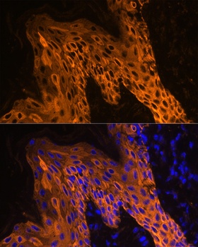 KRT14 Antibody