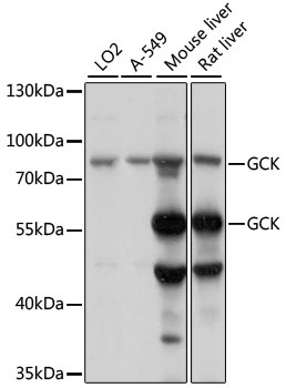 GCK Antibody