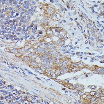 CTTN Antibody