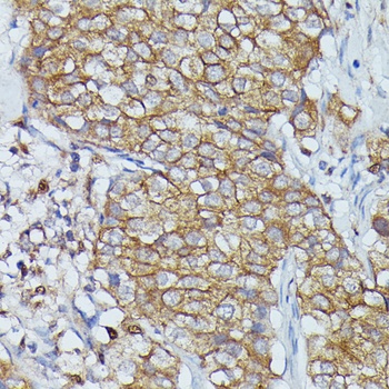 CTTN Antibody