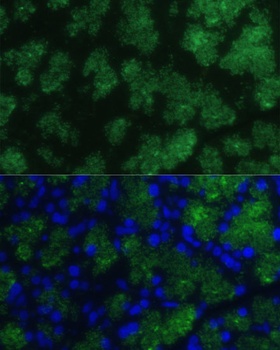 CTRB1 Antibody