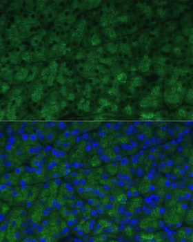 CTRB1 Antibody