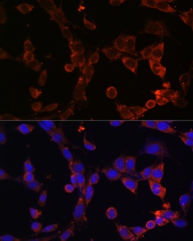 AQP1 Antibody