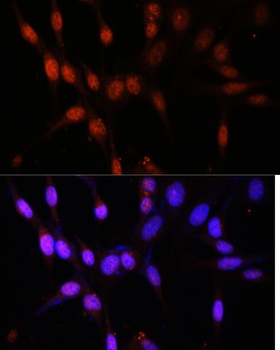 KAT6A Antibody