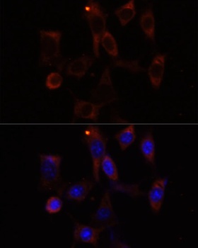 YTHDC2 Antibody