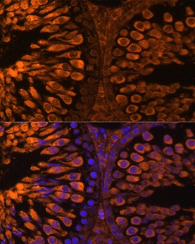 LDHC Antibody