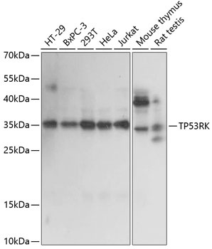 TP53RK Antibody