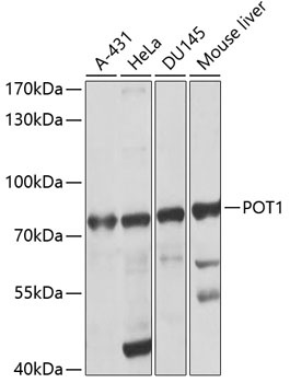 POT1 Antibody