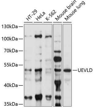 UEVLD Antibody