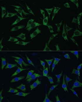 PABPC1 Antibody