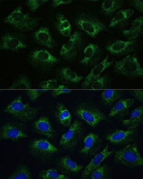 PABPC1 Antibody