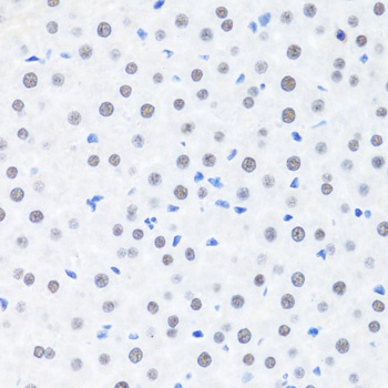 BRMS1 Antibody