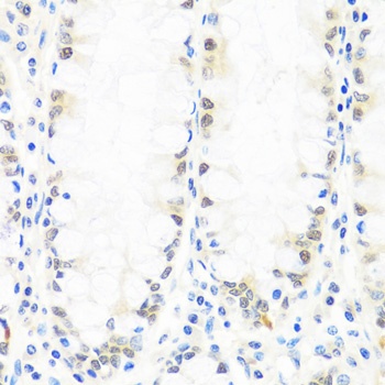 BRMS1 Antibody