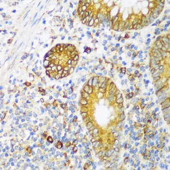 ERLIN1 Antibody