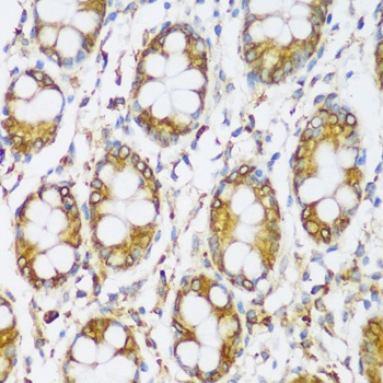 ERLIN1 Antibody