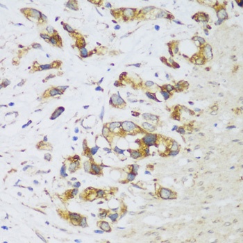 ERLIN1 Antibody