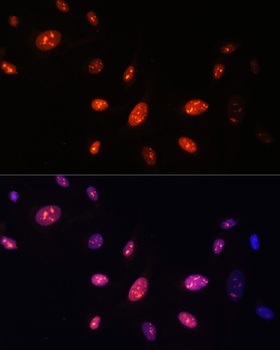 ERLIN1 Antibody