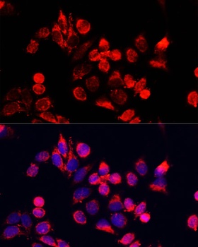 TXN Antibody