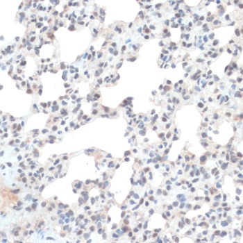 TXN Antibody