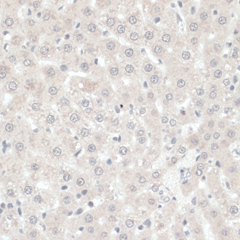 TXN Antibody