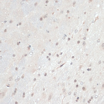 TXN Antibody